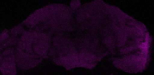 A slice from the stack is shown here