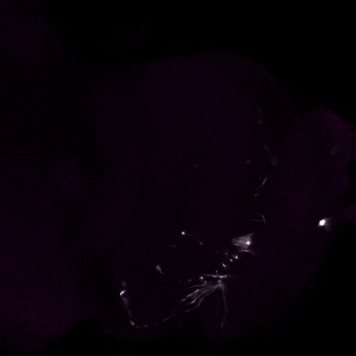 A slice from the stack is shown here