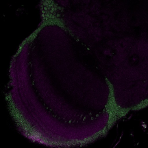 A slice from the stack is shown here