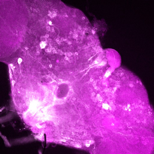 A slice from the stack is shown here