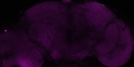 A slice from the stack is shown here