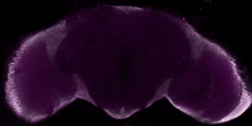 A slice from the stack is shown here