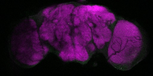 A slice from the stack is shown here