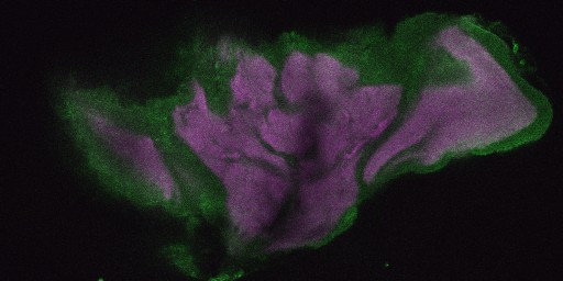A slice from the stack is shown here