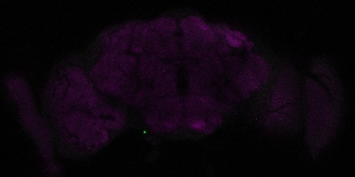 A slice from the stack is shown here