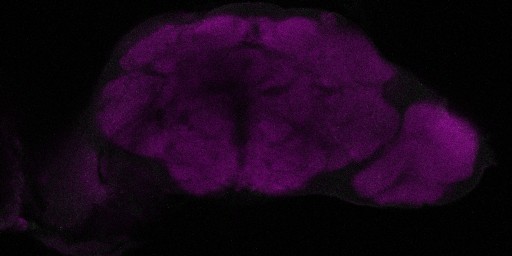 A slice from the stack is shown here