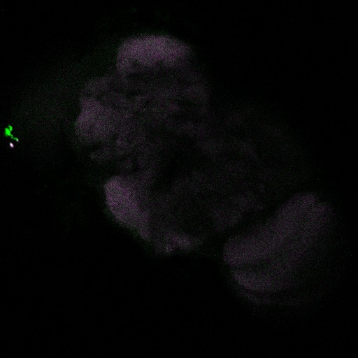 A slice from the stack is shown here