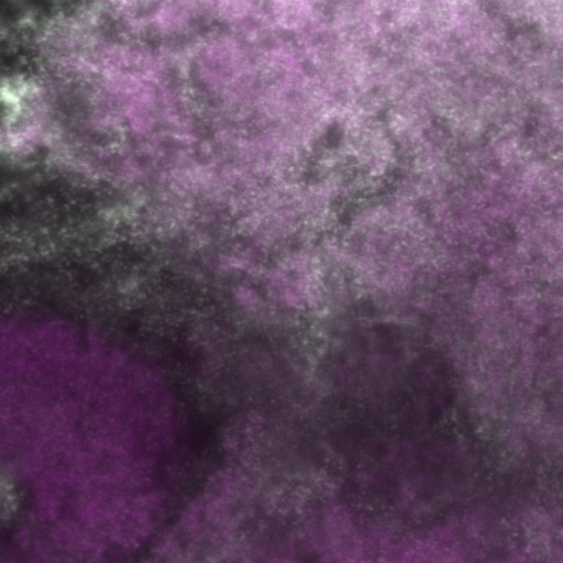 A slice from the stack is shown here