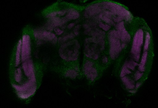 A slice from the stack is shown here