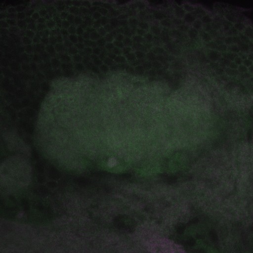 A slice from the stack is shown here