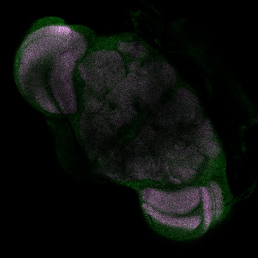 A slice from the stack is shown here
