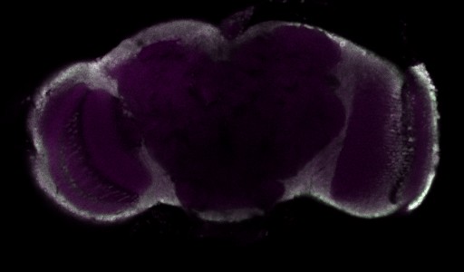 A slice from the stack is shown here