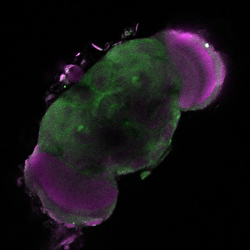 A slice from the stack is shown here