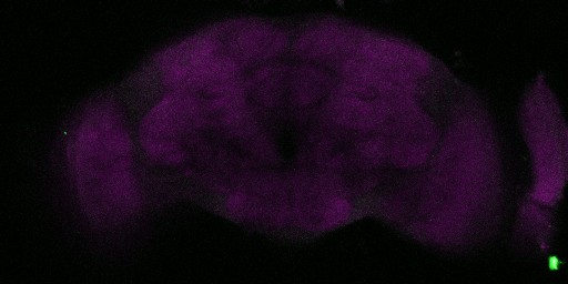 A slice from the stack is shown here
