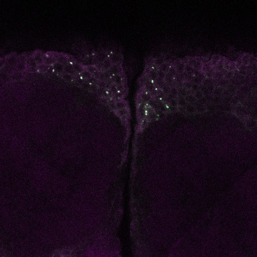 A slice from the stack is shown here