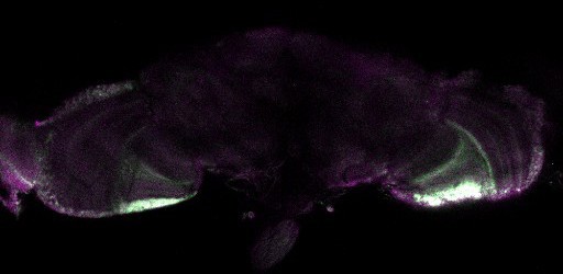 A slice from the stack is shown here